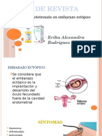 El metotrexato en el tratamiento del embarazo ectópico: reporte de casos y revisiones