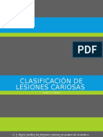Clasificacion de Black y Preparacion de Cavidades Segun Uribe