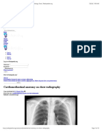 Cardiomediastinal Anatomy On Chest Radiography - Radiology Case