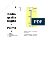 Análisis de Radiografía Digital Carpal