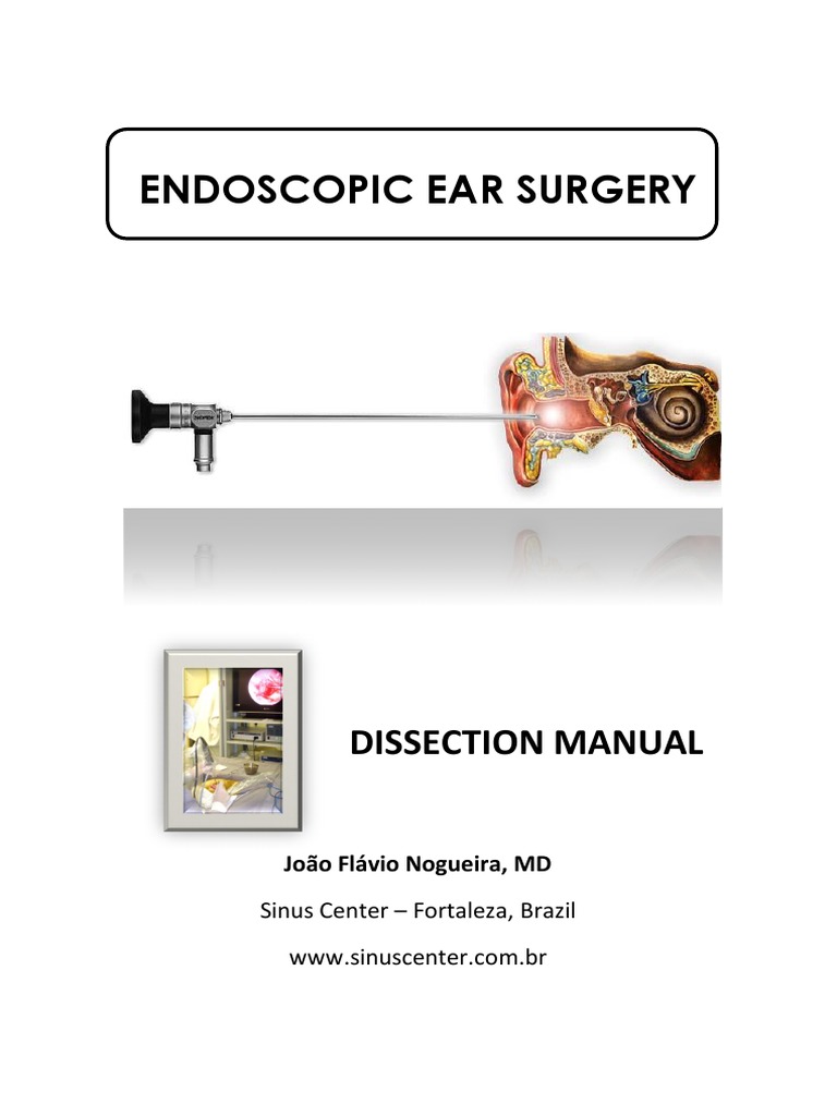 Endoscopic Ear Surgery Manual Endoscopy Surgery Free 30day Trial