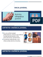 Artritis crónica juvenil.pptx