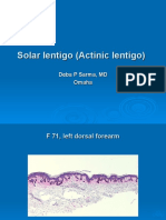 Solar Lentigo (Actinic Lentigo) - F 71, Left Dorsal Forearm.