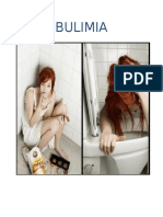 Bulimia