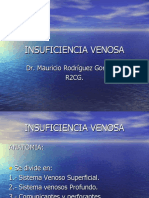 Insuficiencia Venosa