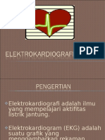 Elektrokardiografi (EKG) NEW