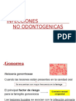 Infecciones No Odontogenicas