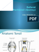 Peritonsil Abses