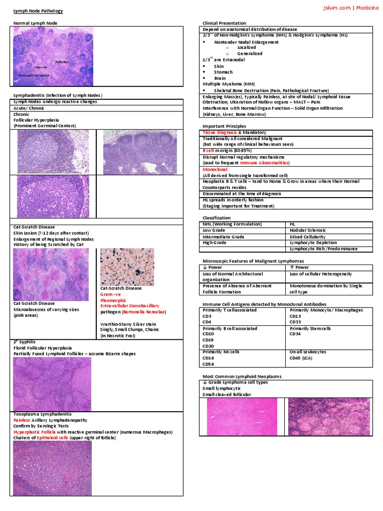 Lymph Node Pathology Pdf Pdf Lymphoma Lymphatic System