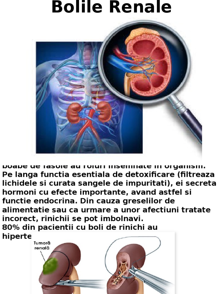 boala de presiune a articulațiilor renale)