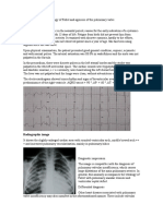 Girl with tetralogy of Fallot and pulmonary valve agenesis