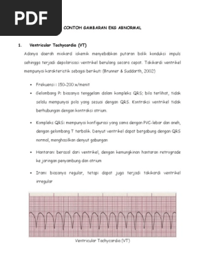 Download 8300 Gambar Ekg Jantung Bermasalah Keren Gratis HD