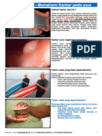 Kanker Usus - Memahami Kanker pada usus - MedicineNet.pdf
