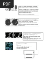 Bakusou Kyoudai Let S Go Return Racers 01