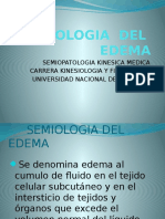 Semiologia Del Edema