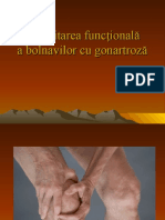 Gonartroza