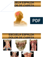 Escuelaespalda-Cefalea Cervicogenica