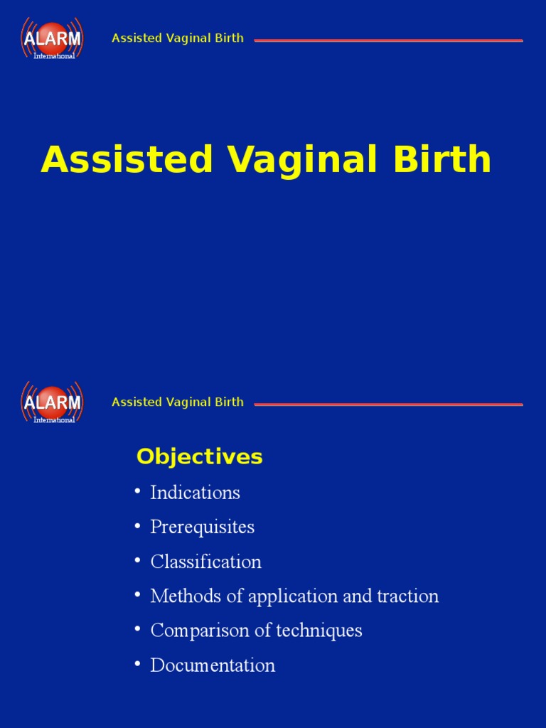 Assisted Vaginal Birth Guidelines | PDF | Childbirth | Women's Health