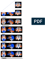 fmri bold activation maps  1 