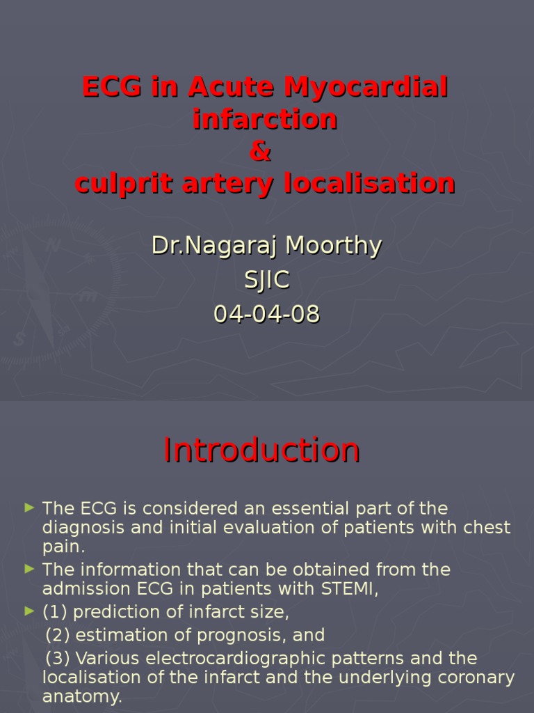 ECG Localization in Myocardial Infarction | PDF | Electrocardiography ...