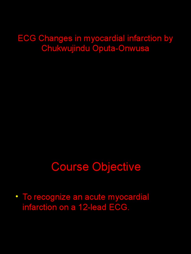 ECG Diagnosis of Myocardial Infarction | PDF | Electrocardiography ...