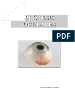 protesis oculares