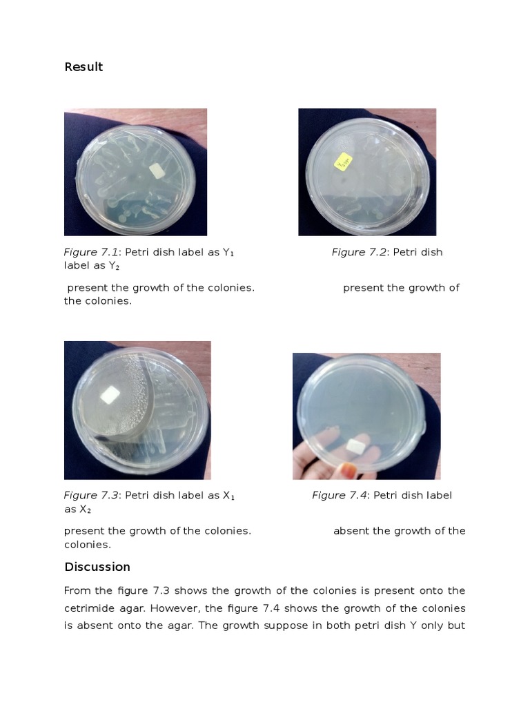 Result Figure 7.1 Petri Dish Label As Y PDF Microbiology