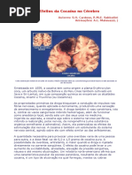 Os Efeitos Da Cocaína No Cérebro