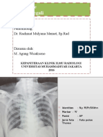 Kardiomegali pada Thorax AP