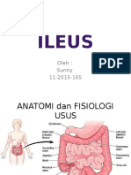 ILEUS