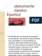 Epulisul 2