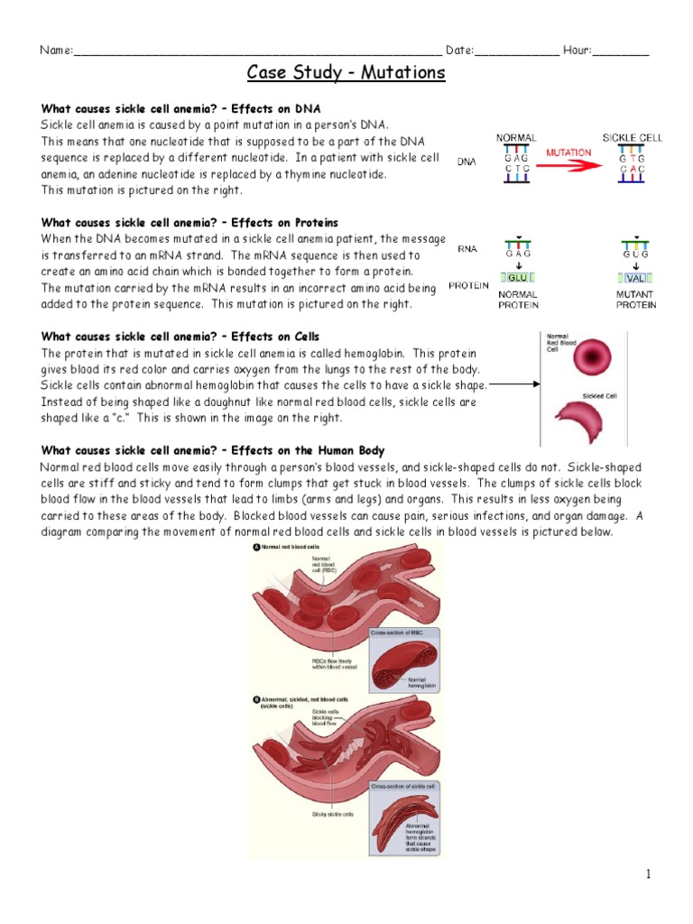 Point mutation in sickle cell anemia image