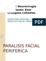 Parálisis facial periférica y hematoma epidural: causas, signos y tratamiento