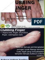 Clubbing Finger