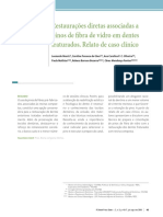 Restauracoes Diretas Associadas A Pinos de Fibra