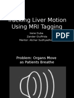 Tracking Liver Motion Using MRI Tagging: Irene Duba Zander Giuffrida Mentor: Atchar Sudhyadhom