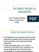 Caria de Dinte Inclus Si Sinusitele 