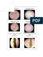 Anfistum 1