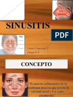 Sinusitis - Otorrino