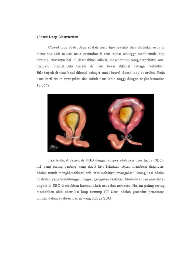 Jojalar qattiq sorishadi