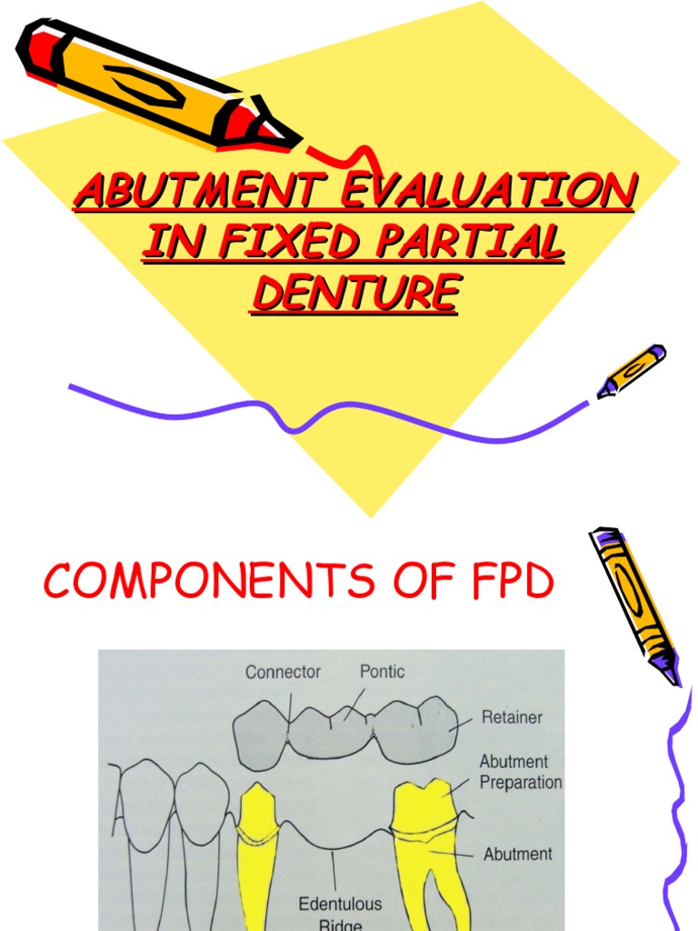 Abutment Evaluation in Fixed Partial Denture PDF Health Sciences