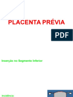 Placenta Prévia e DPP