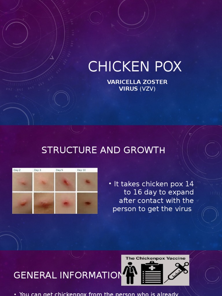 Chicken Pox | PDF