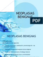 Neoplasias Benignas