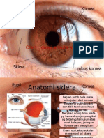 Episkleritis Dan Skleritis