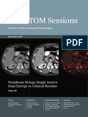PDF] Computed Tomography Measurement of Rib Cage Morphometry in Emphysema