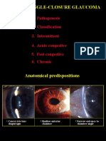 29primary AngleClosure Glau