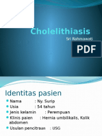Cholelithiasis  SRI.pptx