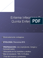 Eritema Infeccioso o Quinta Enfermedad