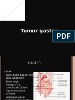 Tumor Gaster